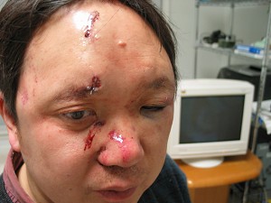 Dr. Peter Yuan LI, nekoliko sati nakon što je pretučen i vezan u svojoj kući u Atlanti, od strane napadača, koji su odnijeli samo kompjutere i dokumente, ali su ostale vrijedne stvari ostale nedirnute. Dr. Li je izjavio da su napadači bili agenti kineskog komunističkog režima, koji su htjeli onemogućiti njegove napore za otkrivanje kršenja ljudskih prava u Kini.